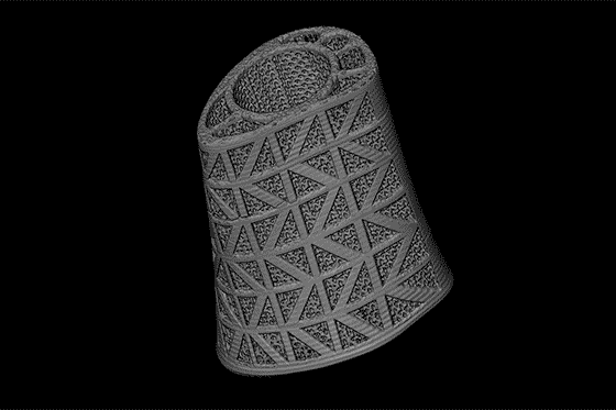 A bone implant constructed using a 3-D printer