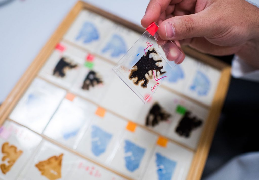 Researcher holds a slice of frontal cortex.