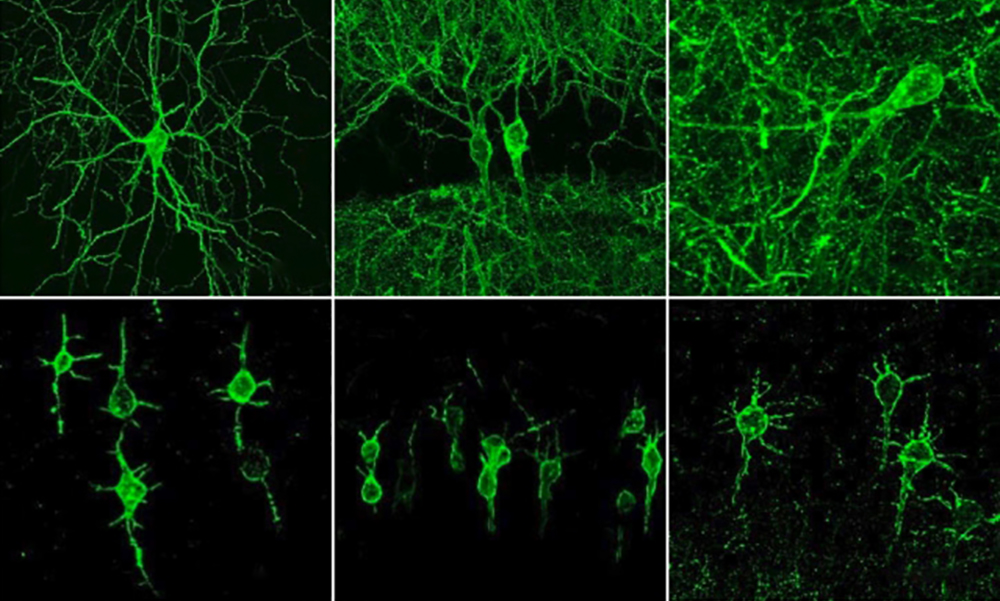 Neurons genetically engineered to contain two types of fluorescing molecules.