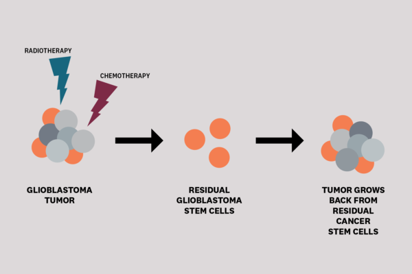 Diagram of Glioblastoma tumor formation.