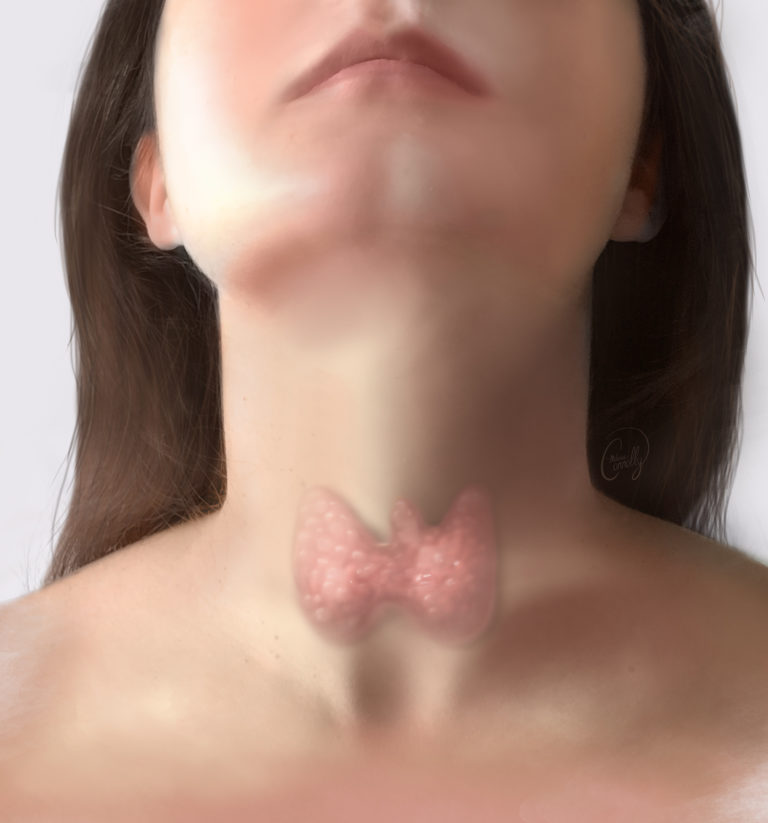 uta-thyroid2.jpg