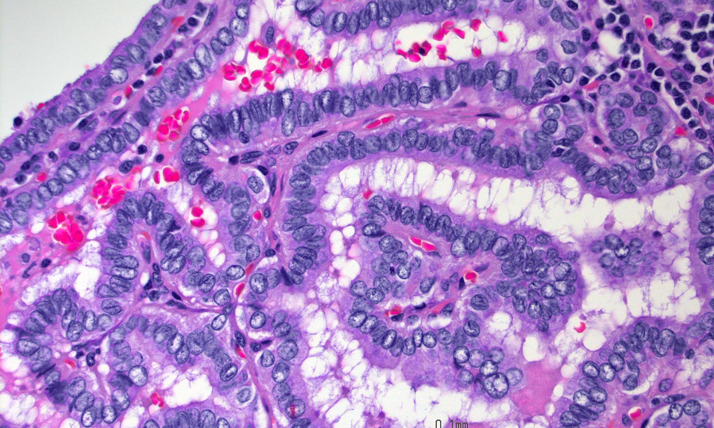 Microscopic view of a thyroid.