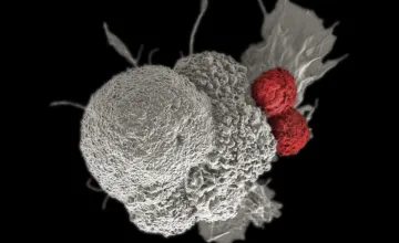 Cancer Drug Restores Immune System’s Ability to Fight Tumors