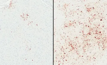 brain tissue