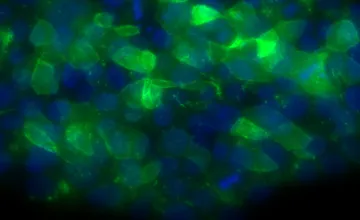"Possible Treatment Strategy Identified for Bone Marrow Failure Syndrome; Shown are human embryonic stem cells engineered to have a mutation that causes bone marrow failure syndrome"