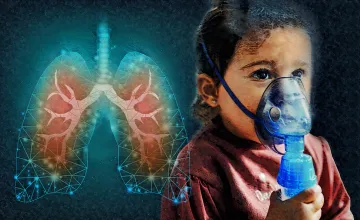 Yale researchers have uncovered a driver of the chronic inflammation that damages lungs in cystic fibrosis. It could be a target for treatment.