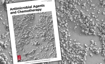 Electron micrograph showing nanoparticles