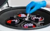 A test tube with blood tests is placed in a centrifuge by a hand in a blue rubber glove