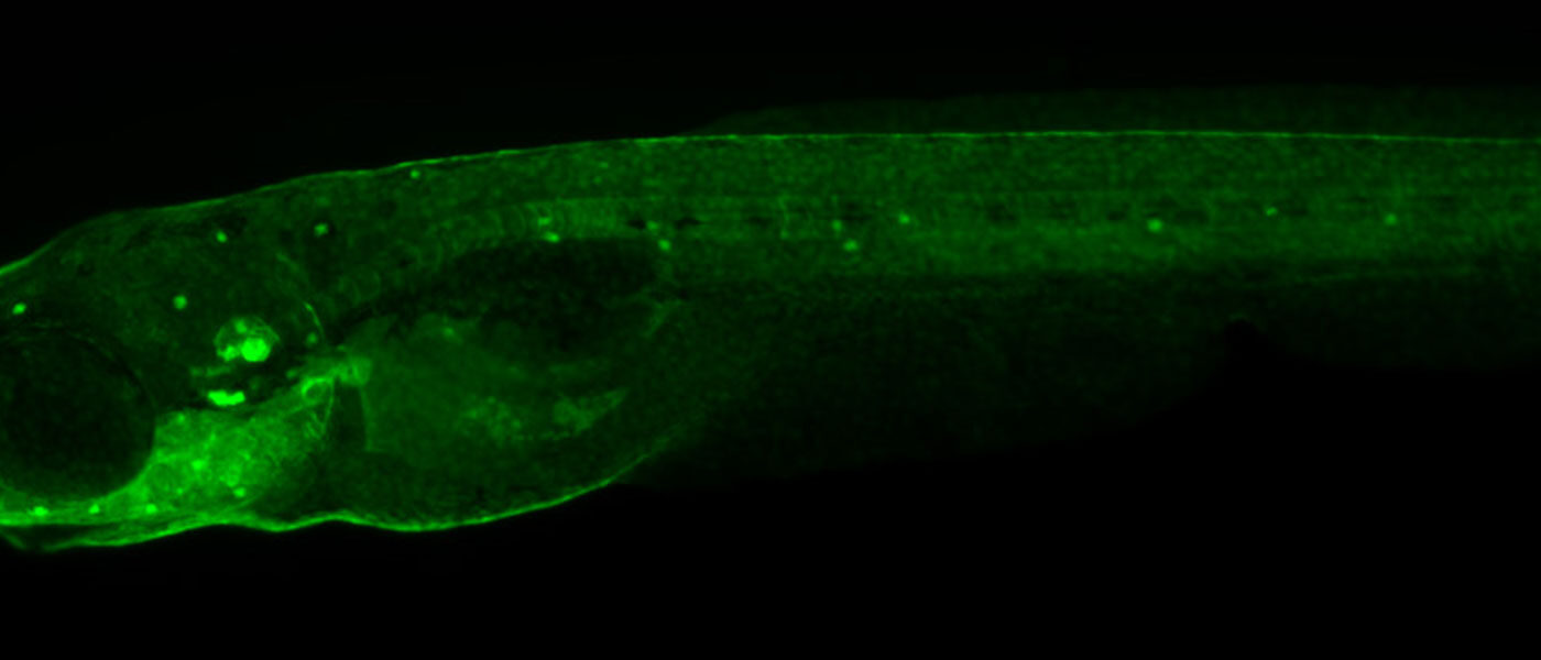 Hairs That Help Fish Feel and Humans Hear
